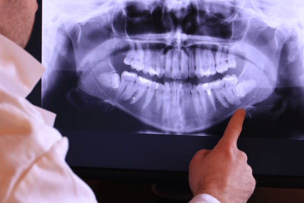 Best Weekend Emergency Dentist in Colmar Manor, MD